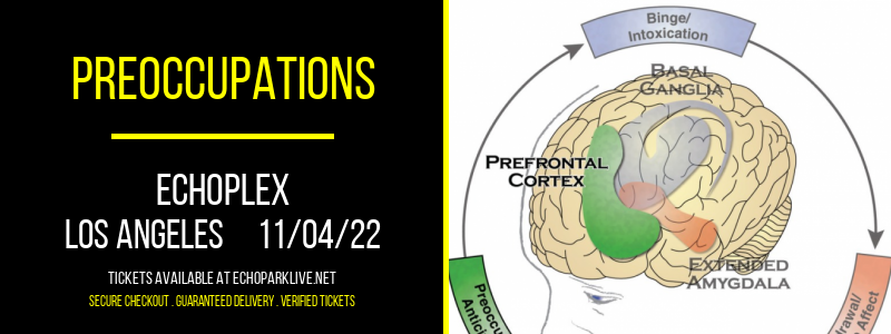 Preoccupations at Echoplex tickets Preoccupations at Echoplex